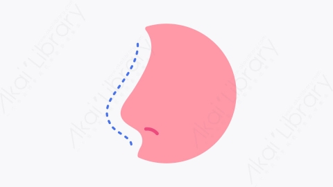 图片素材-025隆鼻 rhinoplasty扁平MG卡通整容手术元素图标