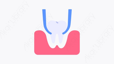 图片素材-033拔牙 tooth extraction扁平MG卡通牙科元素图标