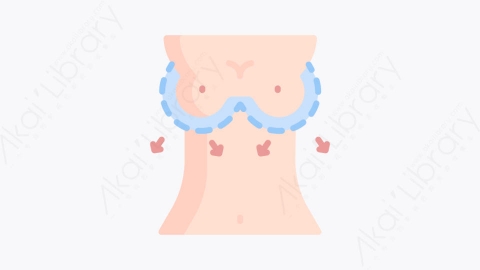 图片素材-041乳房 breastMG卡通整形外科元素图标